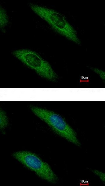 Immunocytochemistry/ Immunofluorescence - Anti-Aldolase B antibody (AB153828), expandable thumbnail