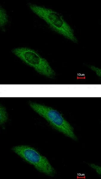 Immunocytochemistry/ Immunofluorescence - Anti-Aldolase B antibody (AB153828)