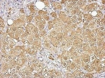 Immunohistochemistry (Formalin/PFA-fixed paraffin-embedded sections) - Anti-Aldolase B antibody (AB153828), expandable thumbnail