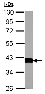 Western blot - Anti-Aldolase B antibody (AB153828), expandable thumbnail