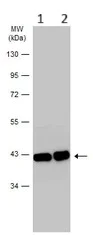 Western blot - Anti-Aldolase B antibody (AB153828)