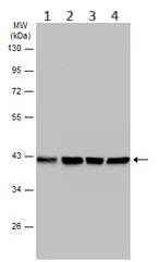 Western blot - Anti-Aldolase B antibody (AB153828)