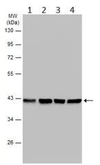 Western blot - Anti-Aldolase B antibody (AB153828)
