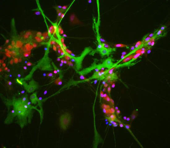 Immunocytochemistry/ Immunofluorescence - Anti-Aldolase C antibody [4A9] - N-terminal (AB190368)