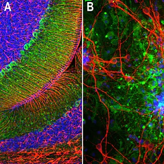Immunocytochemistry/ Immunofluorescence - Anti-Aldolase C antibody [4A9] - N-terminal (AB190368)