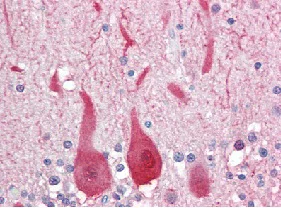 Immunohistochemistry (Formalin/PFA-fixed paraffin-embedded sections) - Anti-Aldolase C antibody (AB115212)