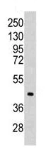 Western blot - Anti-Aldolase C antibody (AB115212)
