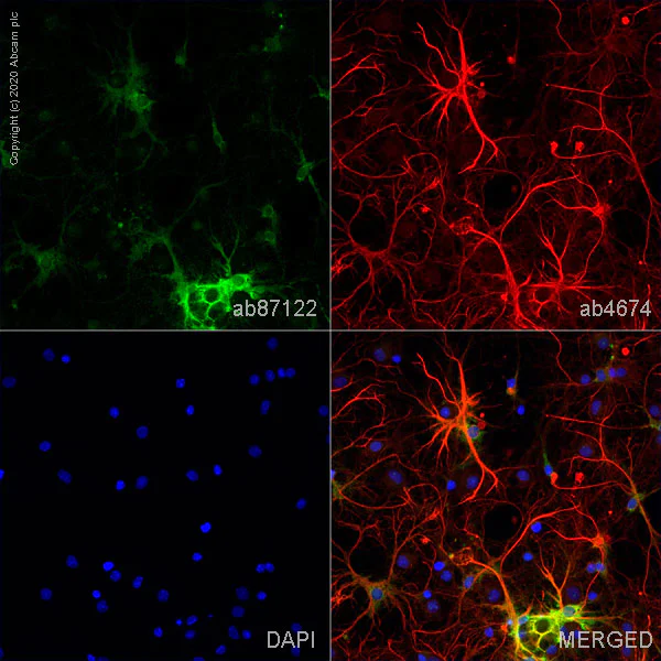 Immunocytochemistry/ Immunofluorescence - Anti-Aldolase C antibody - Astrocyte Marker (AB87122)