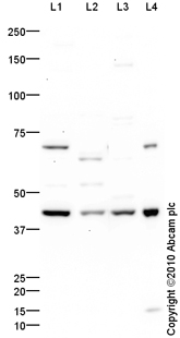 Western blot - Anti-Aldolase C antibody - Astrocyte Marker (AB87122)