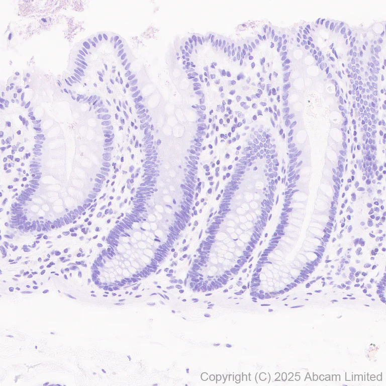Immunohistochemistry (Formalin/PFA-fixed paraffin-embedded sections) - Anti-Aldolase C antibody [EPR26896-61] - C-terminal (AB323506)