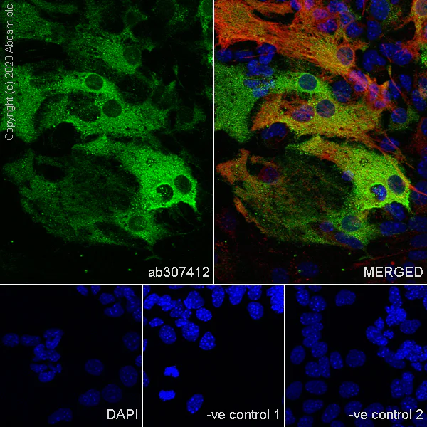 Immunocytochemistry/ Immunofluorescence - Anti-Aldolase C - C-terminal antibody [EPR26896-2] (AB307412)