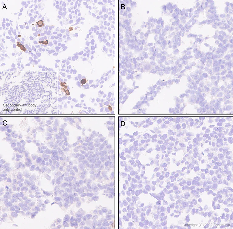 Immunohistochemistry (Formalin/PFA-fixed paraffin-embedded sections) - Anti-Aldolase C - C-terminal antibody [EPR26896-2] (AB307412)