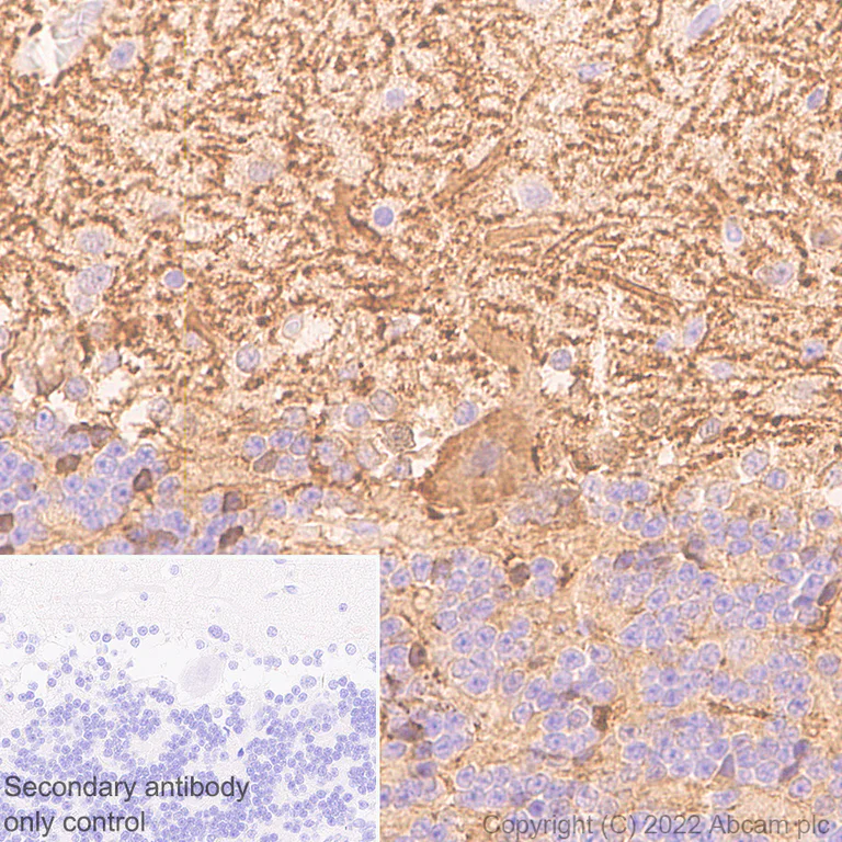Immunohistochemistry (Formalin/PFA-fixed paraffin-embedded sections) - Anti-Aldolase C - C-terminal antibody [EPR26896-2] (AB307412)