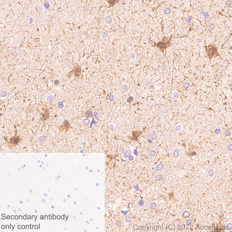 Immunohistochemistry (Formalin/PFA-fixed paraffin-embedded sections) - Anti-Aldolase C - C-terminal antibody [EPR26896-2] (AB307412)