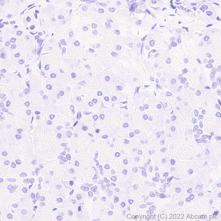 Immunohistochemistry (Formalin/PFA-fixed paraffin-embedded sections) - Anti-Aldolase C - C-terminal antibody [EPR26896-2] (AB307412)