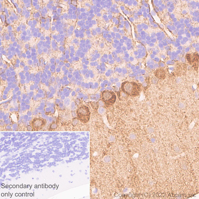 Immunohistochemistry (Formalin/PFA-fixed paraffin-embedded sections) - Anti-Aldolase C - C-terminal antibody [EPR26896-2] (AB307412)