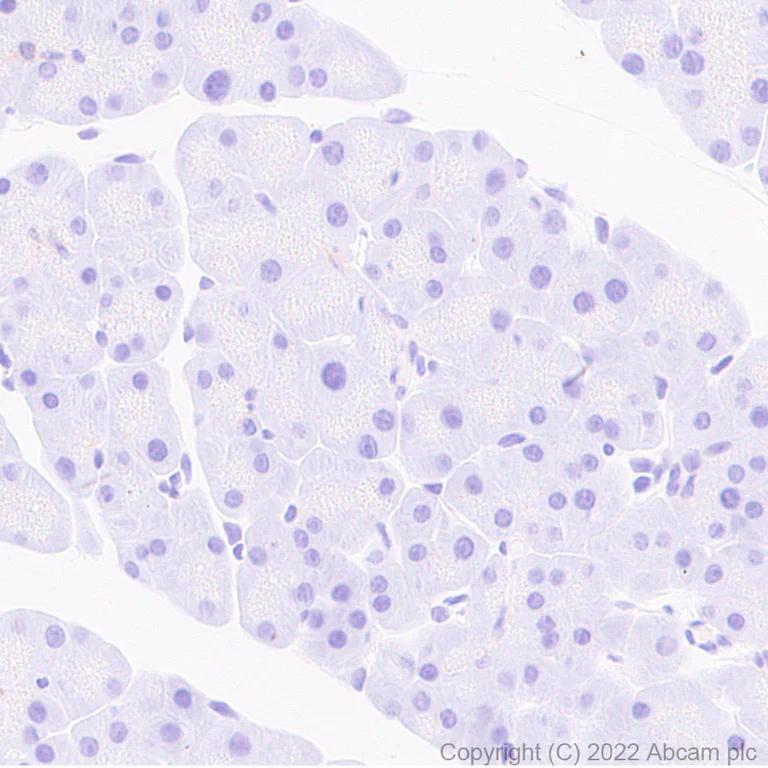 Immunohistochemistry (Formalin/PFA-fixed paraffin-embedded sections) - Anti-Aldolase C - C-terminal antibody [EPR26896-2] (AB307412)