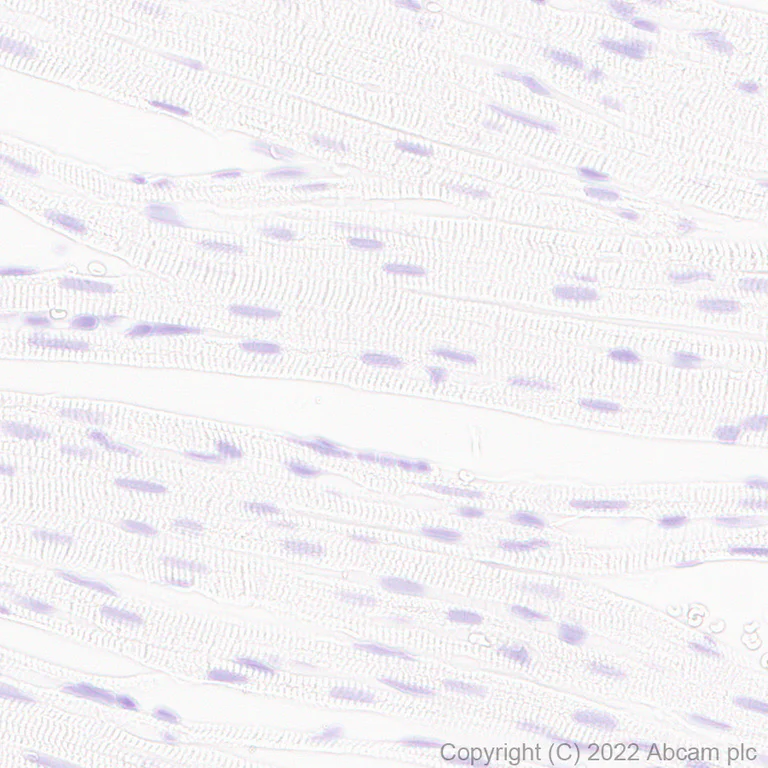Immunohistochemistry (Formalin/PFA-fixed paraffin-embedded sections) - Anti-Aldolase C - C-terminal antibody [EPR26896-2] (AB307412)