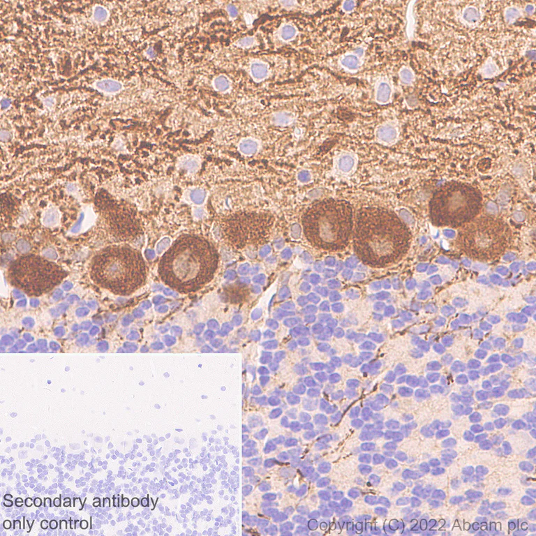 Immunohistochemistry (Formalin/PFA-fixed paraffin-embedded sections) - Anti-Aldolase C - C-terminal antibody [EPR26896-2] (AB307412)