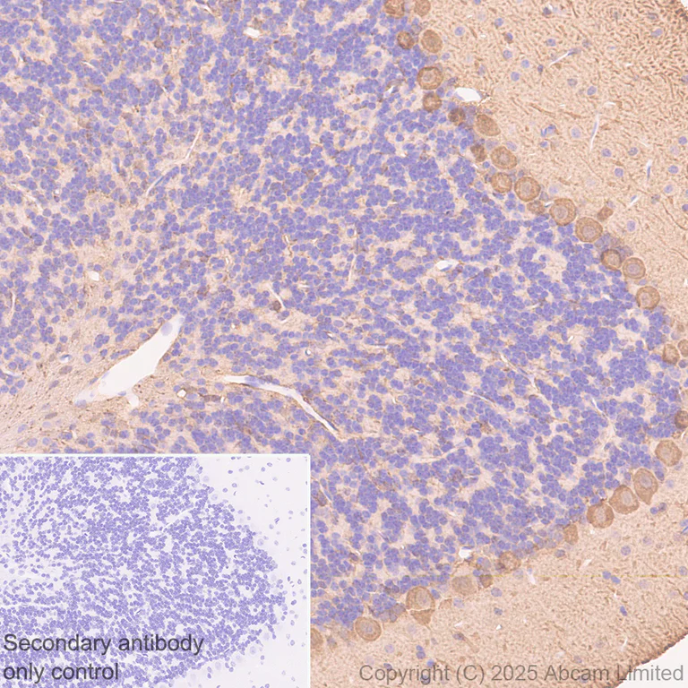 Immunohistochemistry (Formalin/PFA-fixed paraffin-embedded sections) - Anti-Aldolase C - C-terminal antibody [EPR26896-61] - BSA and Azide free (AB323777)