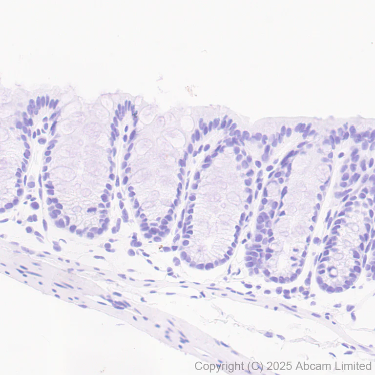 Immunohistochemistry (Formalin/PFA-fixed paraffin-embedded sections) - Anti-Aldolase C - C-terminal antibody [EPR26896-61] - BSA and Azide free (AB323777)
