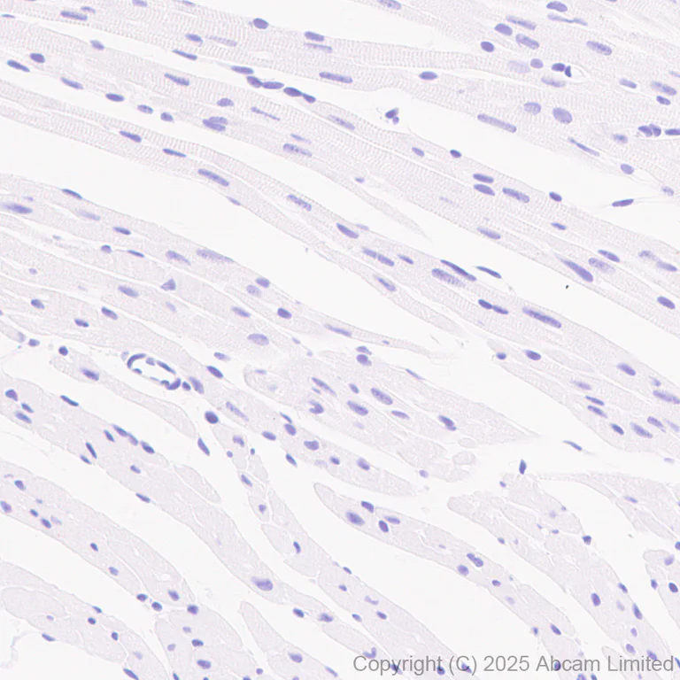 Immunohistochemistry (Formalin/PFA-fixed paraffin-embedded sections) - Anti-Aldolase C - C-terminal antibody [EPR26896-61] - BSA and Azide free (AB323777)