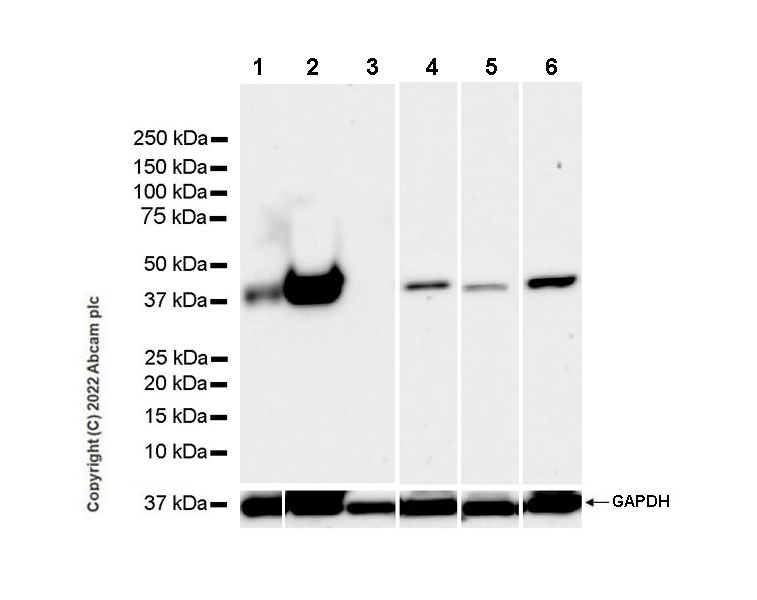 Western blot - Anti-Aldolase C - N-terminal antibody [EPR26895-52] - BSA and Azide free (AB302953), expandable thumbnail