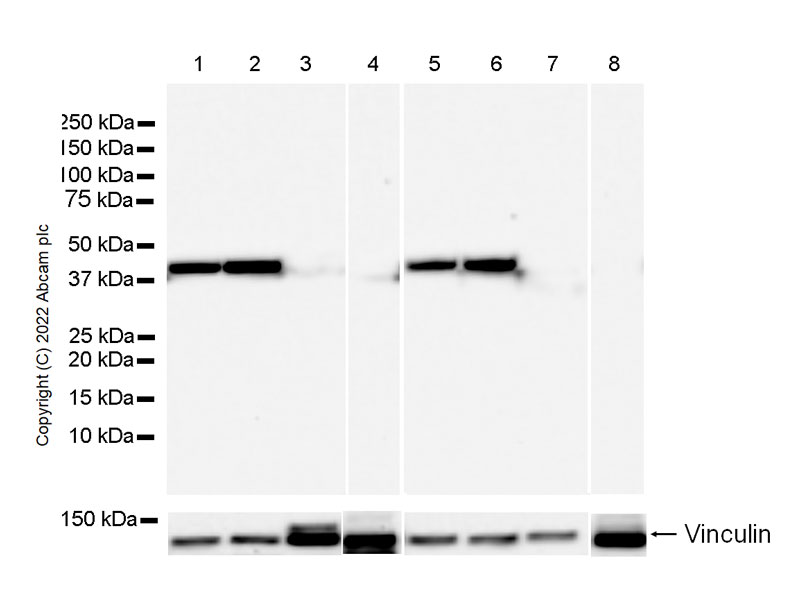 Western blot - Anti-Aldolase C - N-terminal antibody [EPR26895-52] - BSA and Azide free (AB302953), expandable thumbnail