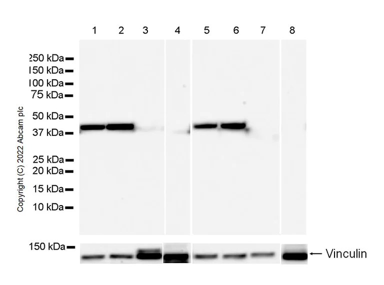 Western blot - Anti-Aldolase C - N-terminal antibody [EPR26895-52] - BSA and Azide free (AB302953)