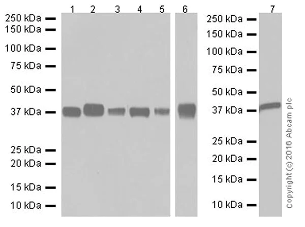 Western blot - Anti-Aldolase+Aldolase C antibody [EPR19355] - BSA and Azide free (AB251296)