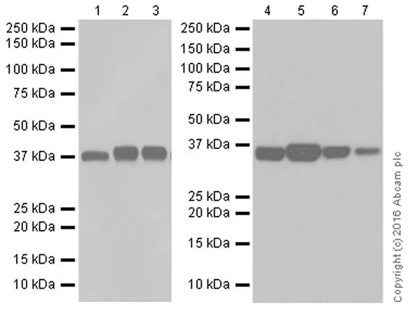 Western blot - Anti-Aldolase+Aldolase C antibody [EPR19355] - BSA and Azide free (AB251296)