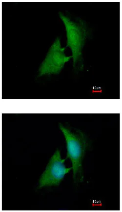 Immunocytochemistry/ Immunofluorescence - Anti-Aldose reductase antibody (AB153897)