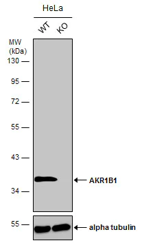 Western blot - Anti-Aldose reductase antibody (AB153897)