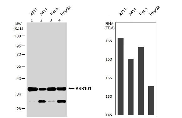 Western blot - Anti-Aldose reductase antibody (AB153897)