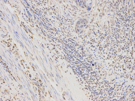 Immunohistochemistry (Formalin/PFA-fixed paraffin-embedded sections) - Anti-Aldose reductase antibody (AB175394)