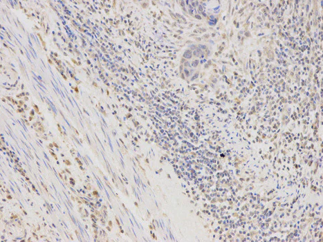 Immunohistochemistry (Formalin/PFA-fixed paraffin-embedded sections) - Anti-Aldose reductase antibody (AB175394)