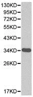 Western blot - Anti-Aldose reductase antibody (AB175394)