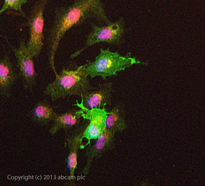 Immunocytochemistry/ Immunofluorescence - Anti-Aldose reductase antibody (AB62795)