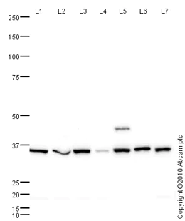 Western blot - Anti-Aldose reductase antibody (AB62795)