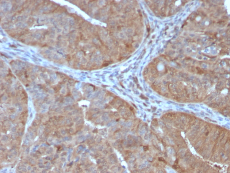 Immunohistochemistry (Formalin/PFA-fixed paraffin-embedded sections) - Anti-Aldose reductase antibody [CPTC-AKR1B1-2] - BSA and Azide free (AB268179), expandable thumbnail