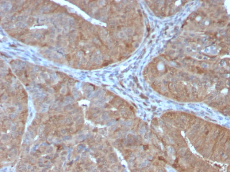 Immunohistochemistry (Formalin/PFA-fixed paraffin-embedded sections) - Anti-Aldose reductase antibody [CPTC-AKR1B1-2] - BSA and Azide free (AB268179)
