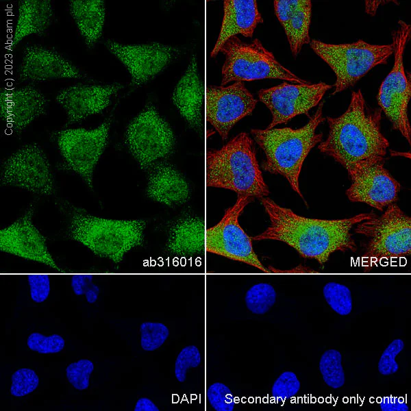 Immunocytochemistry/ Immunofluorescence - Anti-Aldose reductase antibody [EPR28780-7] (AB316016)