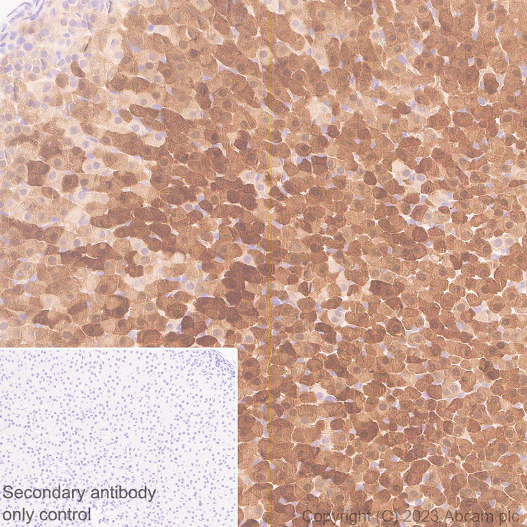 Immunohistochemistry (Formalin/PFA-fixed paraffin-embedded sections) - Anti-Aldose reductase antibody [EPR28780-7] (AB316016)