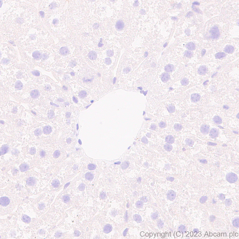 Immunohistochemistry (Formalin/PFA-fixed paraffin-embedded sections) - Anti-Aldose reductase antibody [EPR28780-7] (AB316016)
