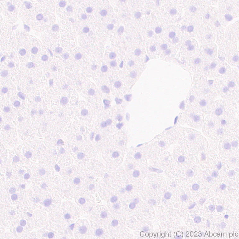 Immunohistochemistry (Formalin/PFA-fixed paraffin-embedded sections) - Anti-Aldose reductase antibody [EPR28780-7] (AB316016)