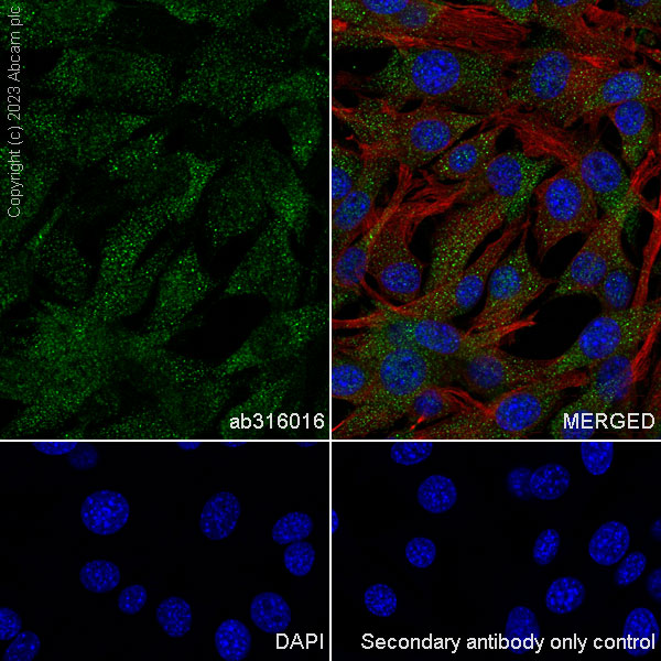 Immunocytochemistry/ Immunofluorescence - Anti-Aldose reductase antibody [EPR28780-7] - BSA and Azide free (ab316017), expandable thumbnail