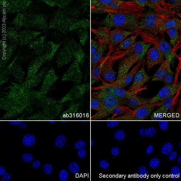 Immunocytochemistry/ Immunofluorescence - Anti-Aldose reductase antibody [EPR28780-7] - BSA and Azide free (AB316017)