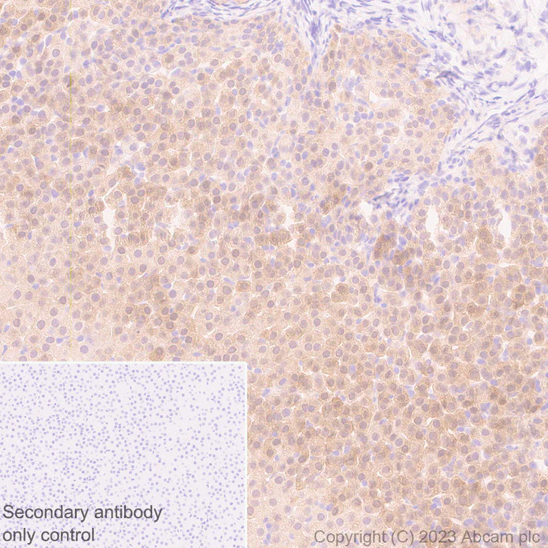 Immunohistochemistry (Formalin/PFA-fixed paraffin-embedded sections) - Anti-Aldose reductase antibody [EPR28780-7] - BSA and Azide free (AB316017)