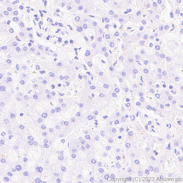 Immunohistochemistry (Formalin/PFA-fixed paraffin-embedded sections) - Anti-Aldose reductase antibody [EPR28780-7] - BSA and Azide free (AB316017)