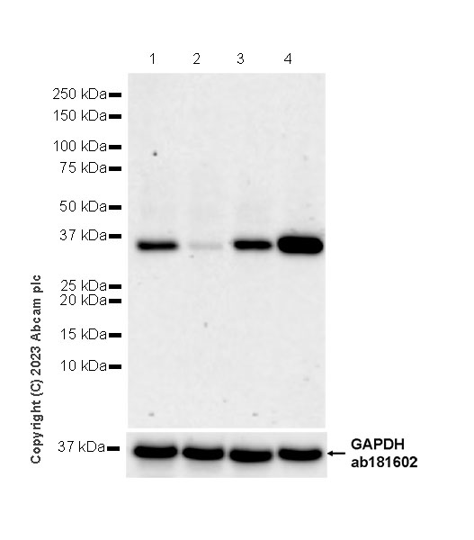 Western blot - Anti-Aldose reductase antibody [EPR28780-7] - BSA and Azide free (ab316017), expandable thumbnail